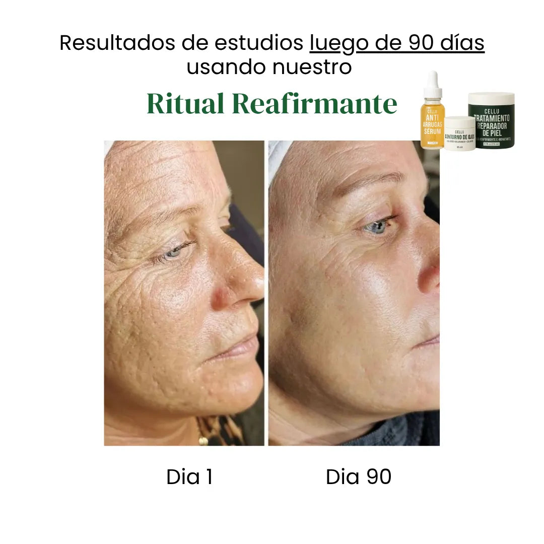 Ritual Reafirmante Completo Cellu