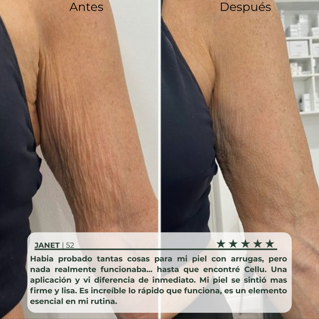 Tratamiento Reafirmante & Anti Celulitis